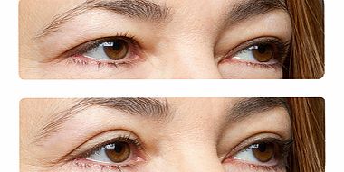 Easy Lift Eye Lift Strips