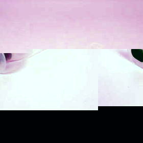 FAW Guedal Airway Size 2 - Green