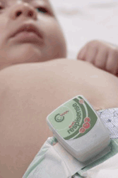 Infant Trust Respisense Baby Breathing Effort Monitor