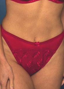 Tango ll Thong