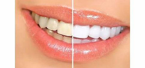 SaySure - Whitener Teeth Whitening Pen Tooth Gel Bleach Stain Eraser Remove Instant