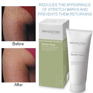 Skin Doctors Stretch Away Stretch Mark Reduction Cream (200ml)