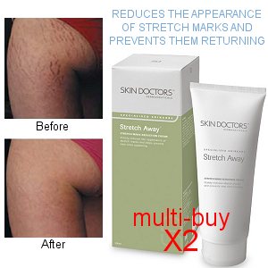 Skin Doctors Stretch Away Stretch Mark Reduction Cream Multi-Buy (200ml x 2)