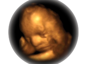 3D/4D baby scan experience
