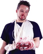 Fancy Dress Costumes - Broken Arm In Sling