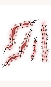 Unbranded STITCH TRANSFER