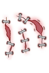 Tattoo: Staple Stitch