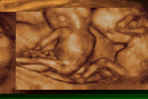 Unbranded Ultrasound Babyscan